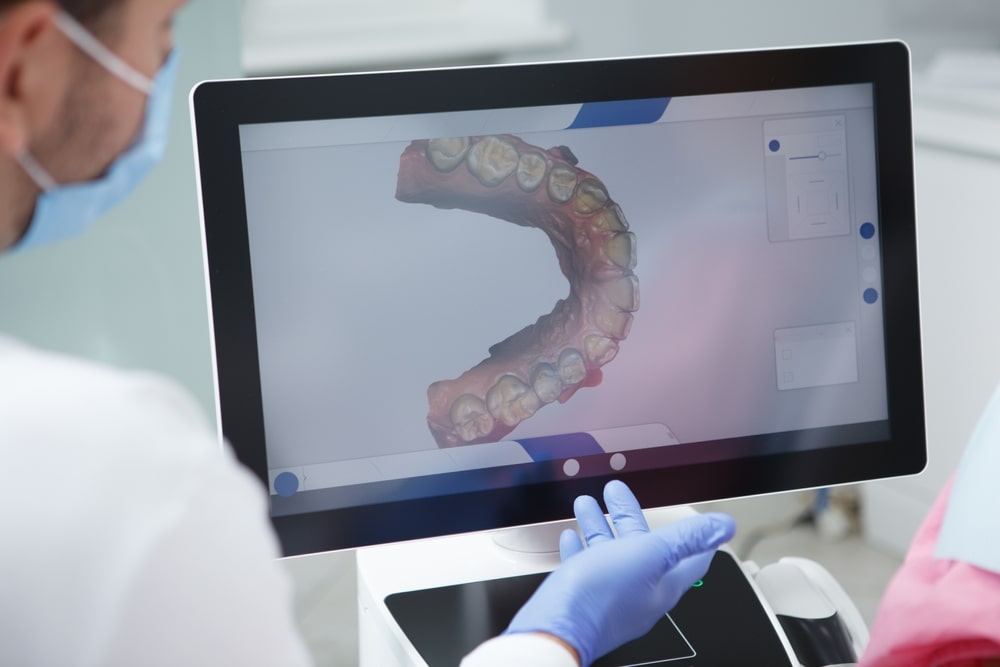 dentist examining teeth scan on the computer