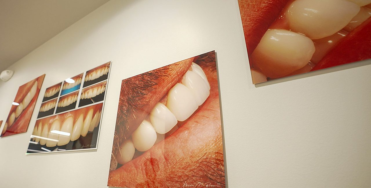 Bellevue WA Dental Implant Dentists