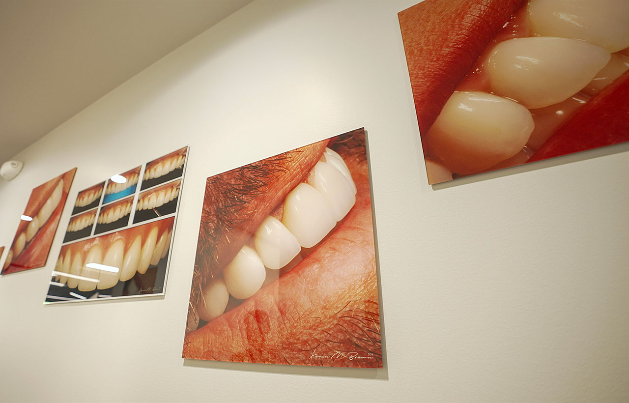 Bellevue WA Dental Implant Dentists