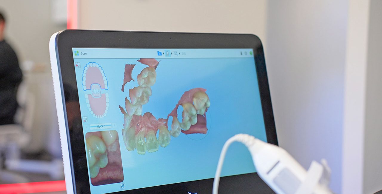 Bellevue WA Invisalign Dentists