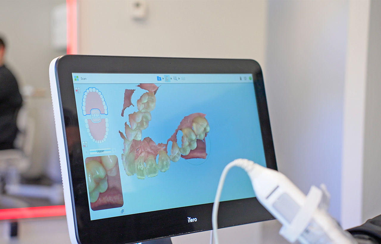 Bellevue WA Invisalign Dentists